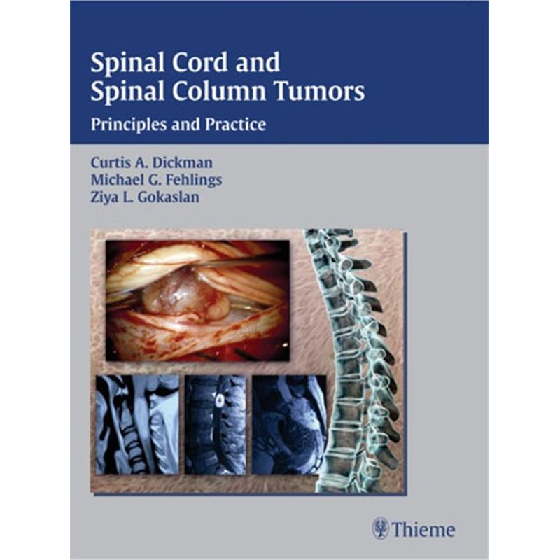 Spinal Cord and Spinal Column Tumors - Principles and Practice